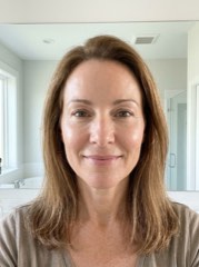 Depois · Susan, 47